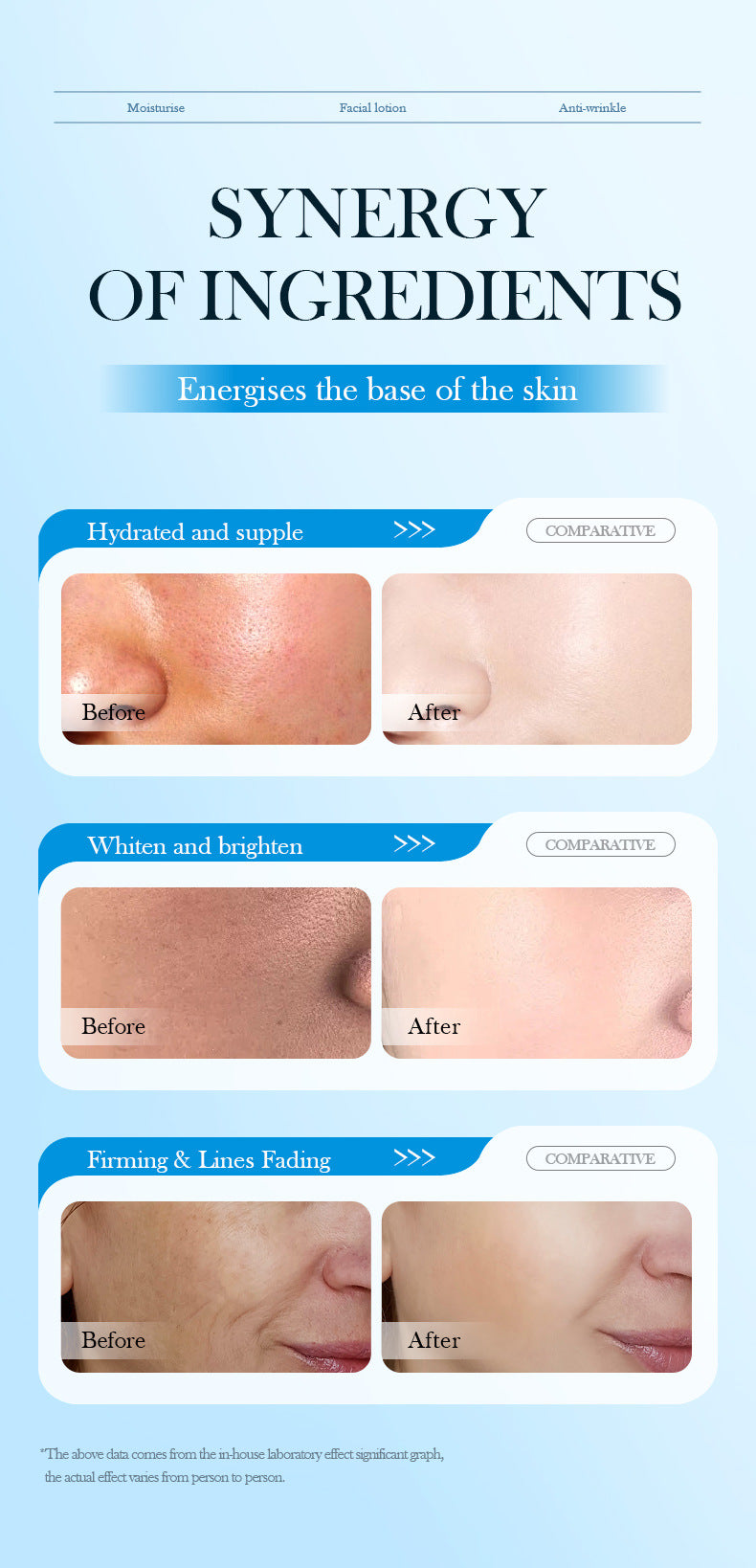 Hyaluronic Acid Face Cream SADOER8D Anti-wrinkle Hydrating Nourishing Face Cream Moisturizing and Rejuvenating  Foreign Trade Wholesale
