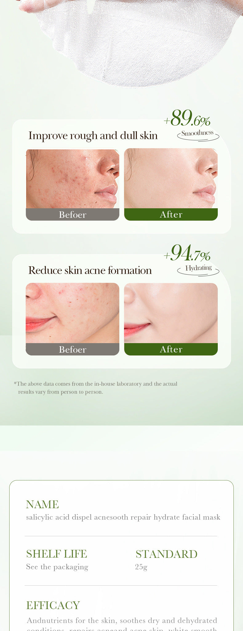 Salicylic Acid Mask SADOER Anti-acne Soothing Skin Rejuvenation Hydrating Anti-acne Mask  Wholesale