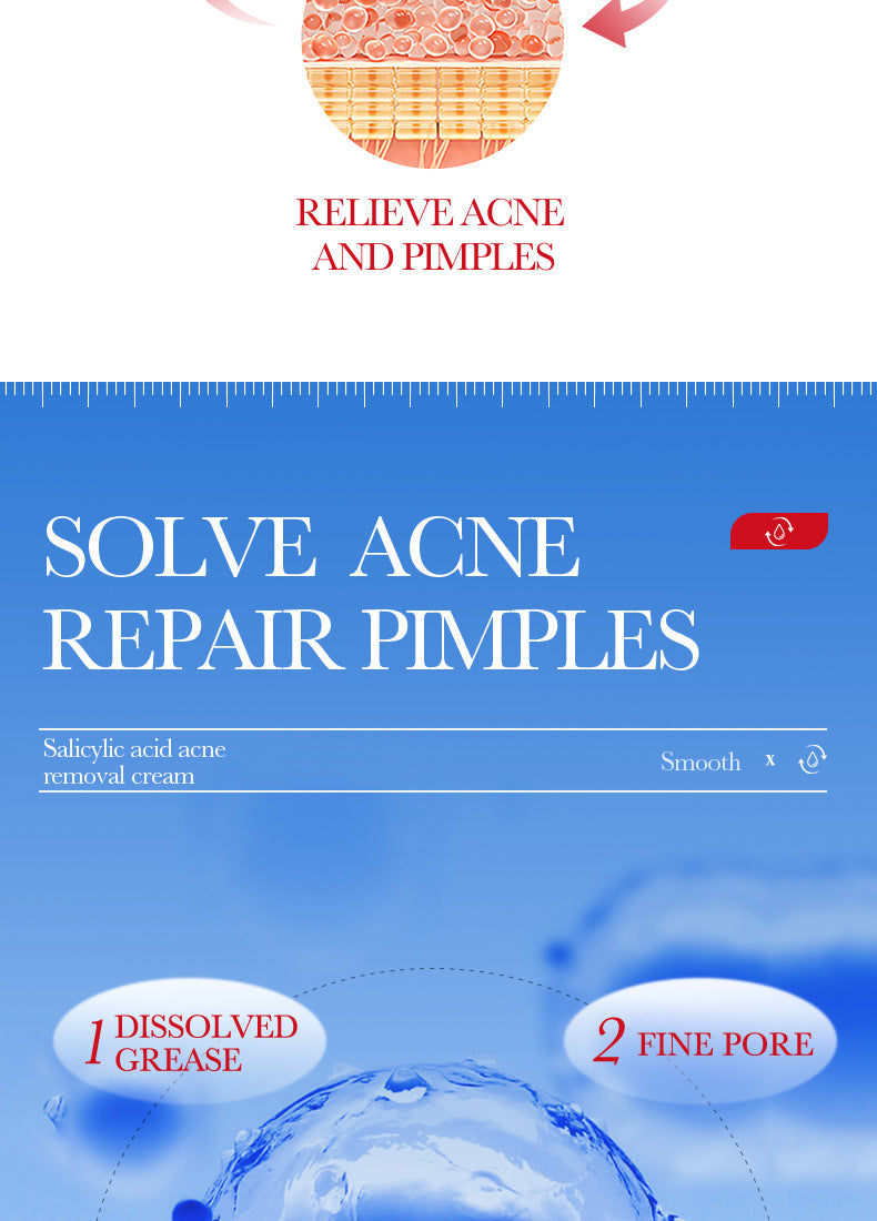 Cream BIOAOUA Salicylic Acid Moisturizing Hydrating Fading Acne Marks  Wholesale