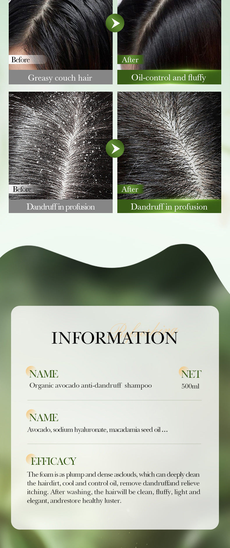 Avocado Anti-Dandruff Oil Control Shampoo SADOER Fluffy Deep Cleansing Shampoo  Wholesale