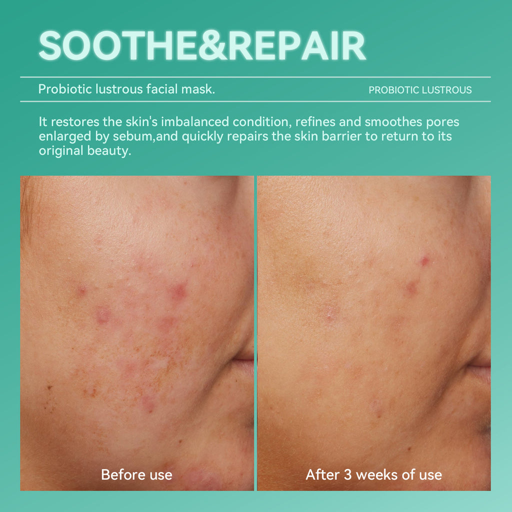 Probiotic Hydrating Mask Set for Moisturizing, Stabilizing, Repairing, Seasonal Changes, Night Recovery, and Soothing