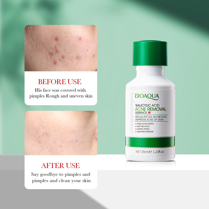 Essence Serum35ml BIOAOUA Salicylic acid moisturizing and hydrating  wholesale