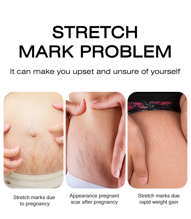 Factory Direct Supply MOIKA Full Pregnancy Firming and Lightening Cream Postpartum Repair Cream Wholesale In Stock
