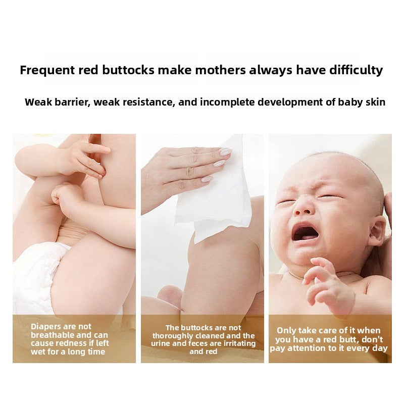 ukepoe Baby Diaper Rash Cream Newborn Red PP Care Processing Improve Butt Redness Baby Diaper Rash Cream OEM