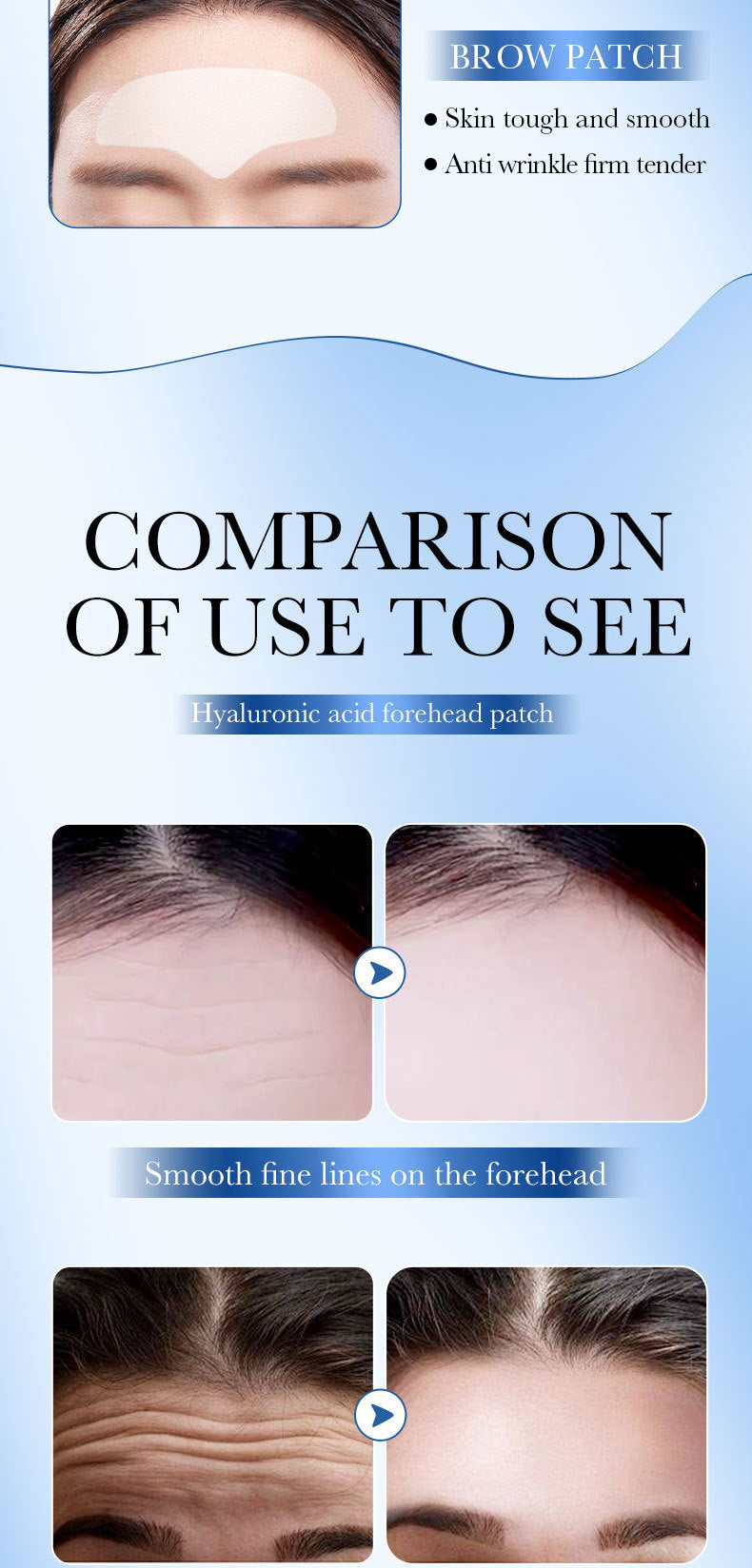 Hyaluronic Acid Forehead Patch SADOER Collagen Firming Improves Forehead Wrinkles  Wholesale