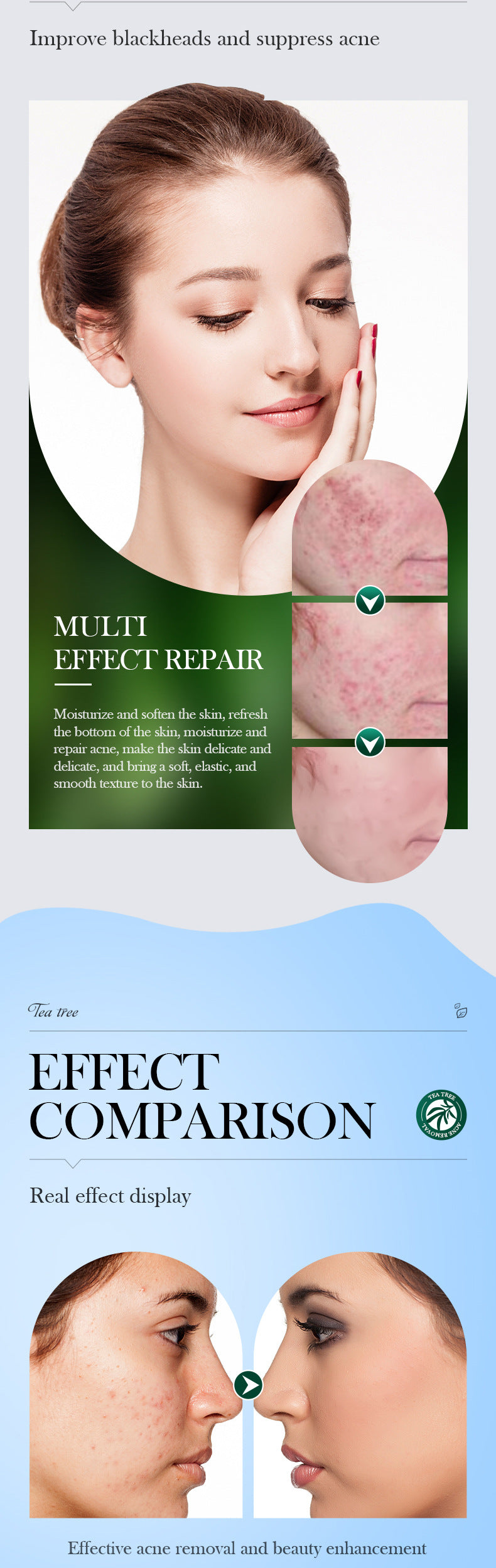 Tea Tree Skincare Set SADOER Cleansing, moisturizing, hydrating five-piece set for  foreign trade wholesale