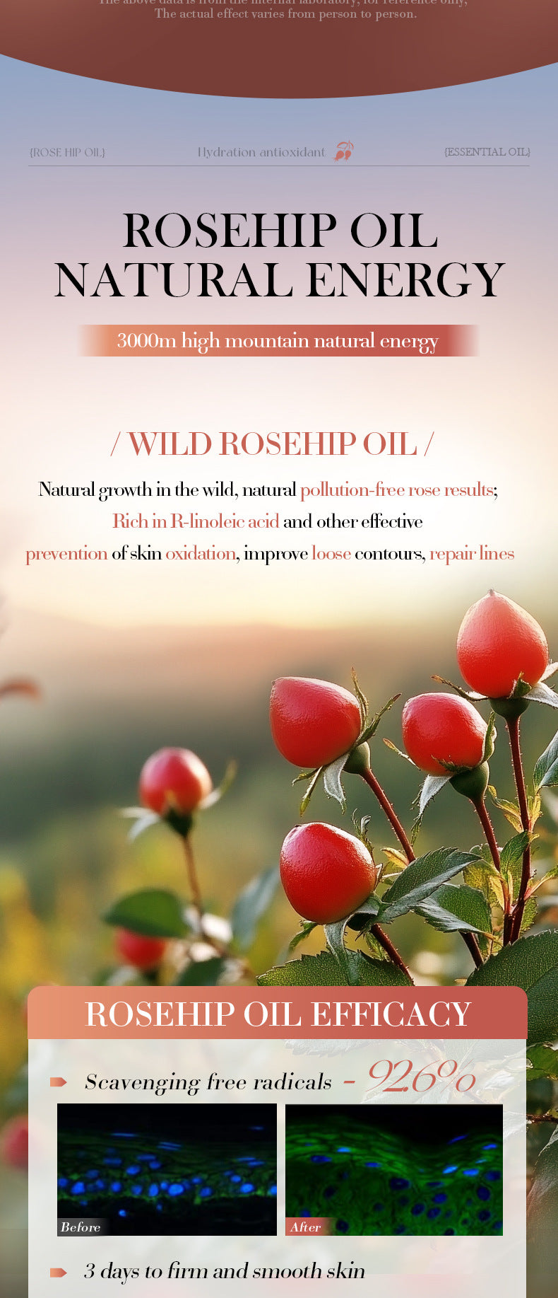 Rosehip Antioxidant Hydrating Essence SADOER Moisturizing facial essential oil cross-border foreign trade wholesale