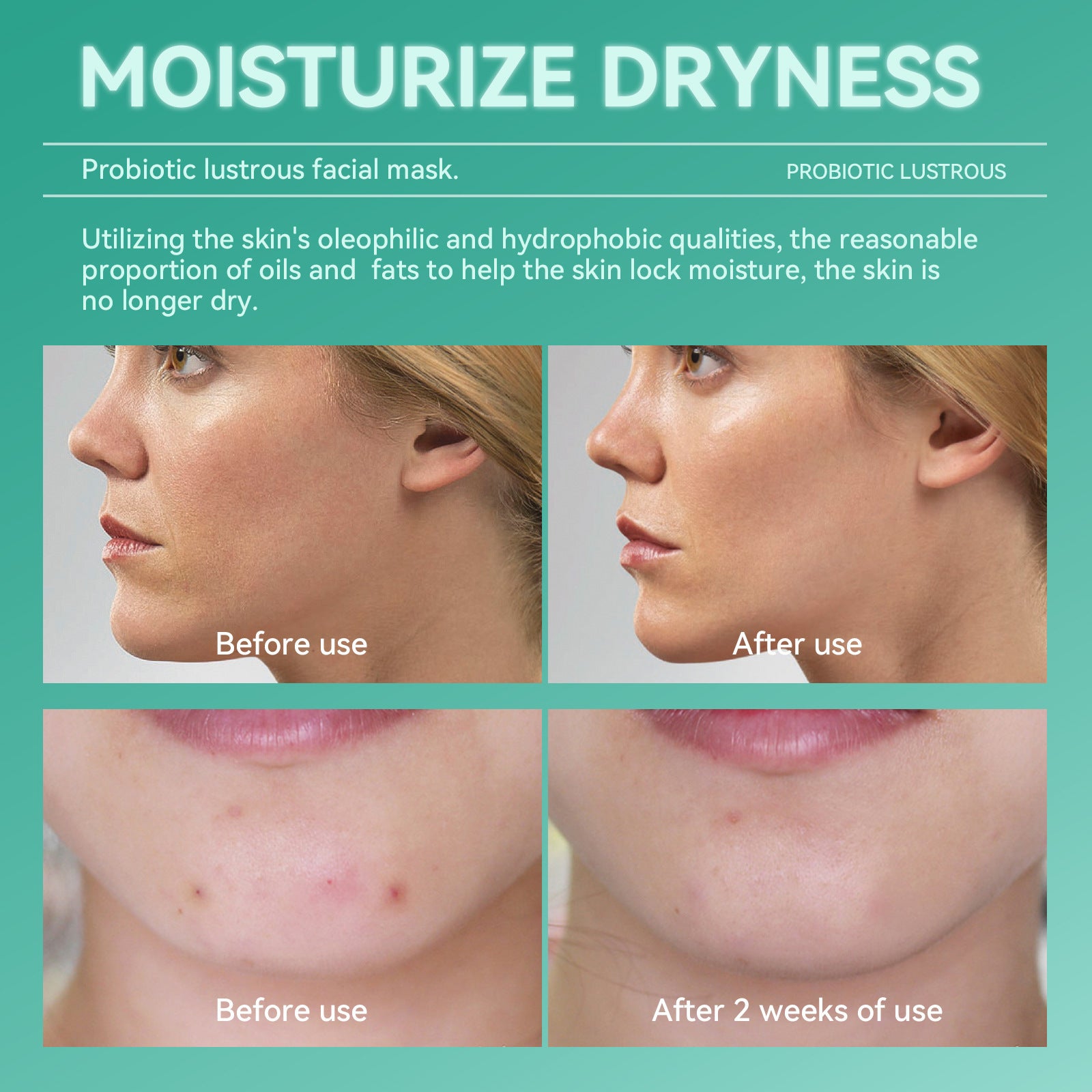 Probiotic Hydrating Mask Set for Moisturizing, Stabilizing, Repairing, Seasonal Changes, Night Recovery, and Soothing