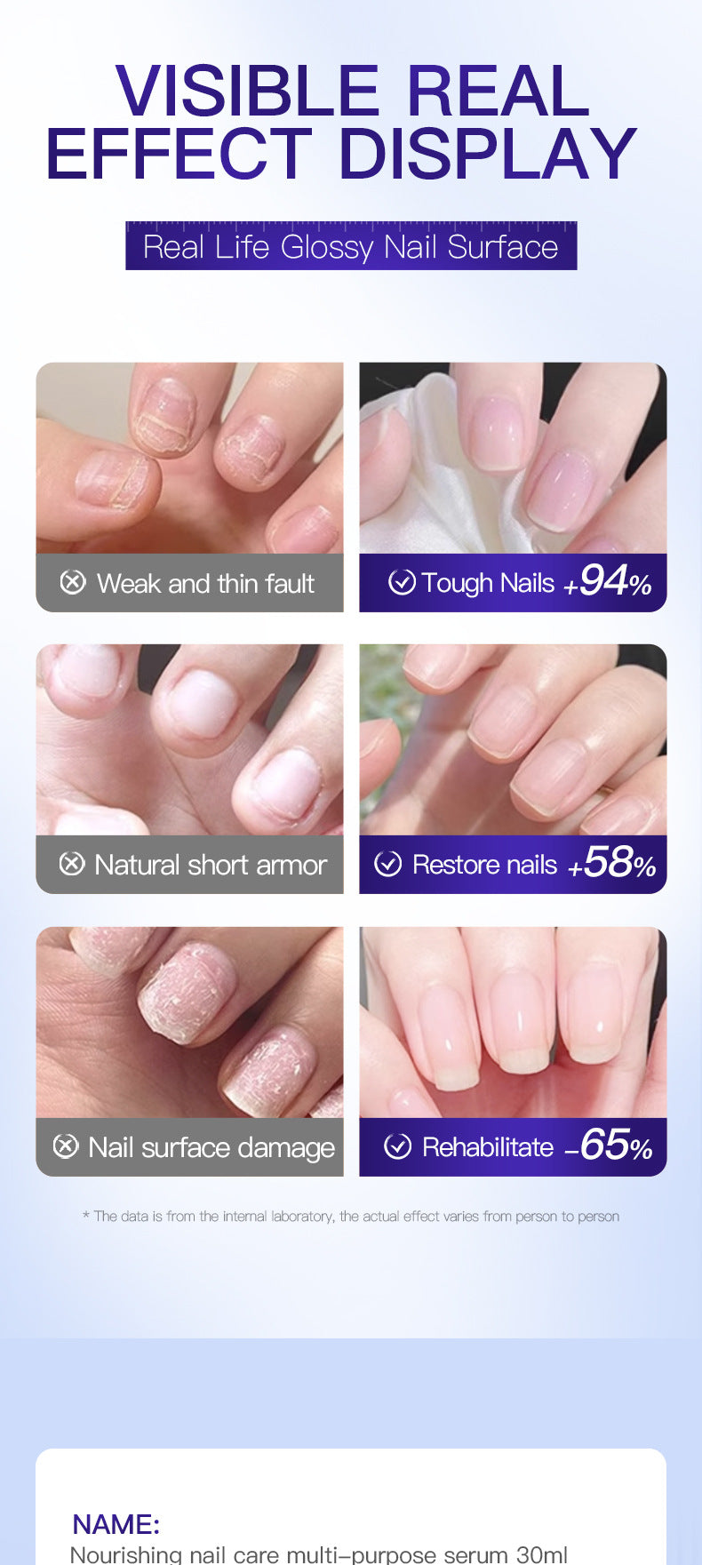 Moisturizing Nail Care Essence SADOER Skin rejuvenation and moisturizing essence liquid  wholesale