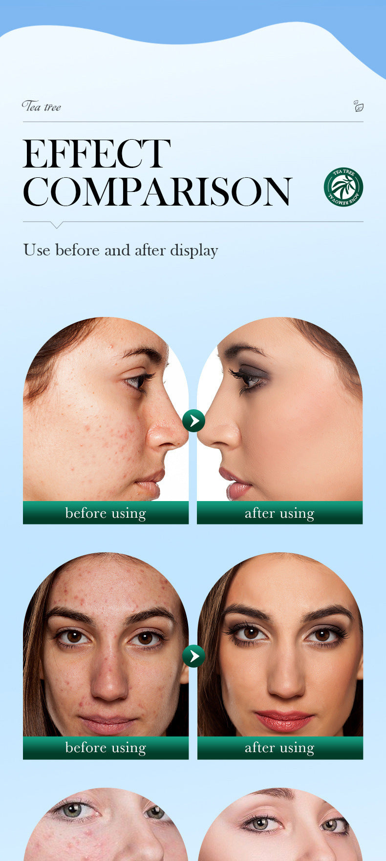 Tea Tree Facial Cleanser100gSADOER Deep Cleansing Moisturizing Refreshing Cleanser  Wholesale