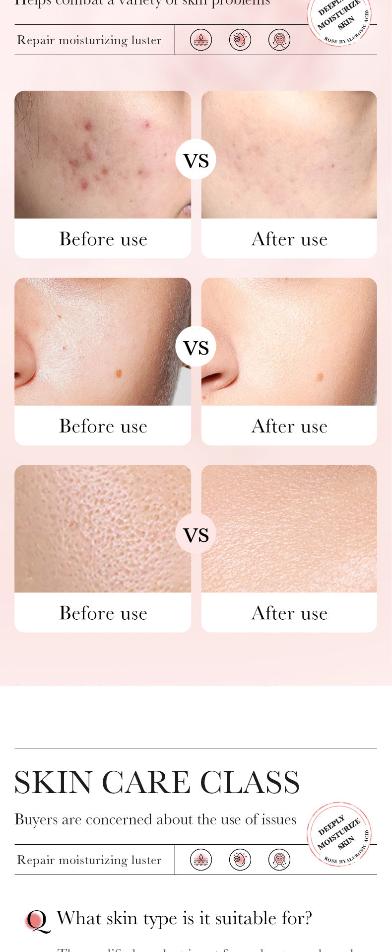 Rose Skincare Set BIOAOUA Hyaluronic acid moisturizing six-piece set  foreign trade wholesale