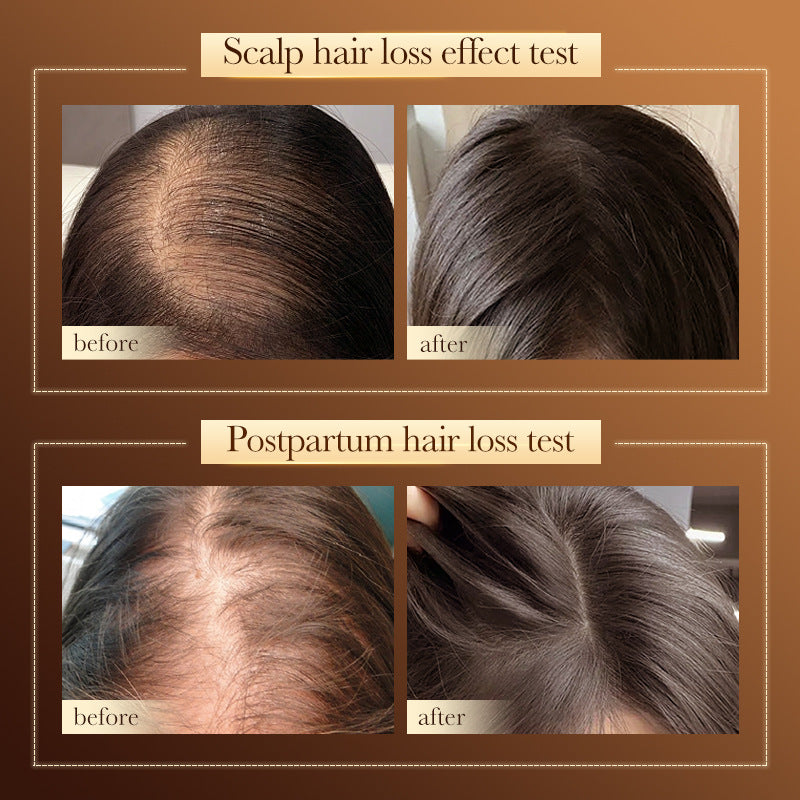 Shampoo500ml SADOER Hydrating Smooth Anti-Hair Loss Anti-Dandruff Shampoo  Wholesale
