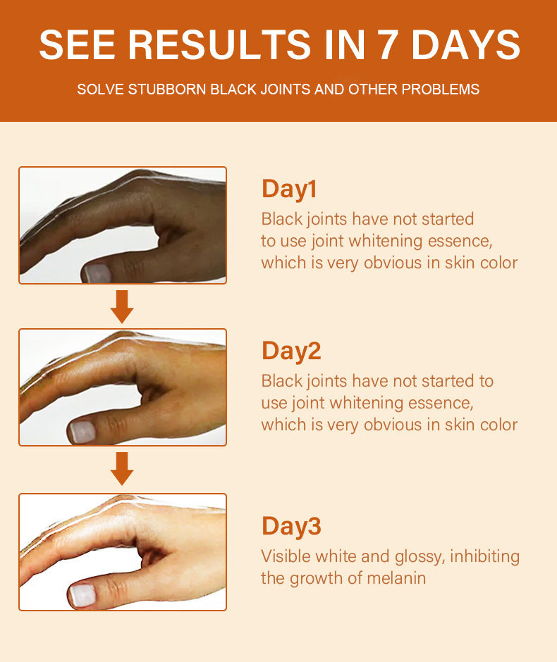 Joint Darkening Essence for Knees and Ankles, Brightens Skin Tone and Reduces Spots Full Coverage Dark Spot Removal Essence