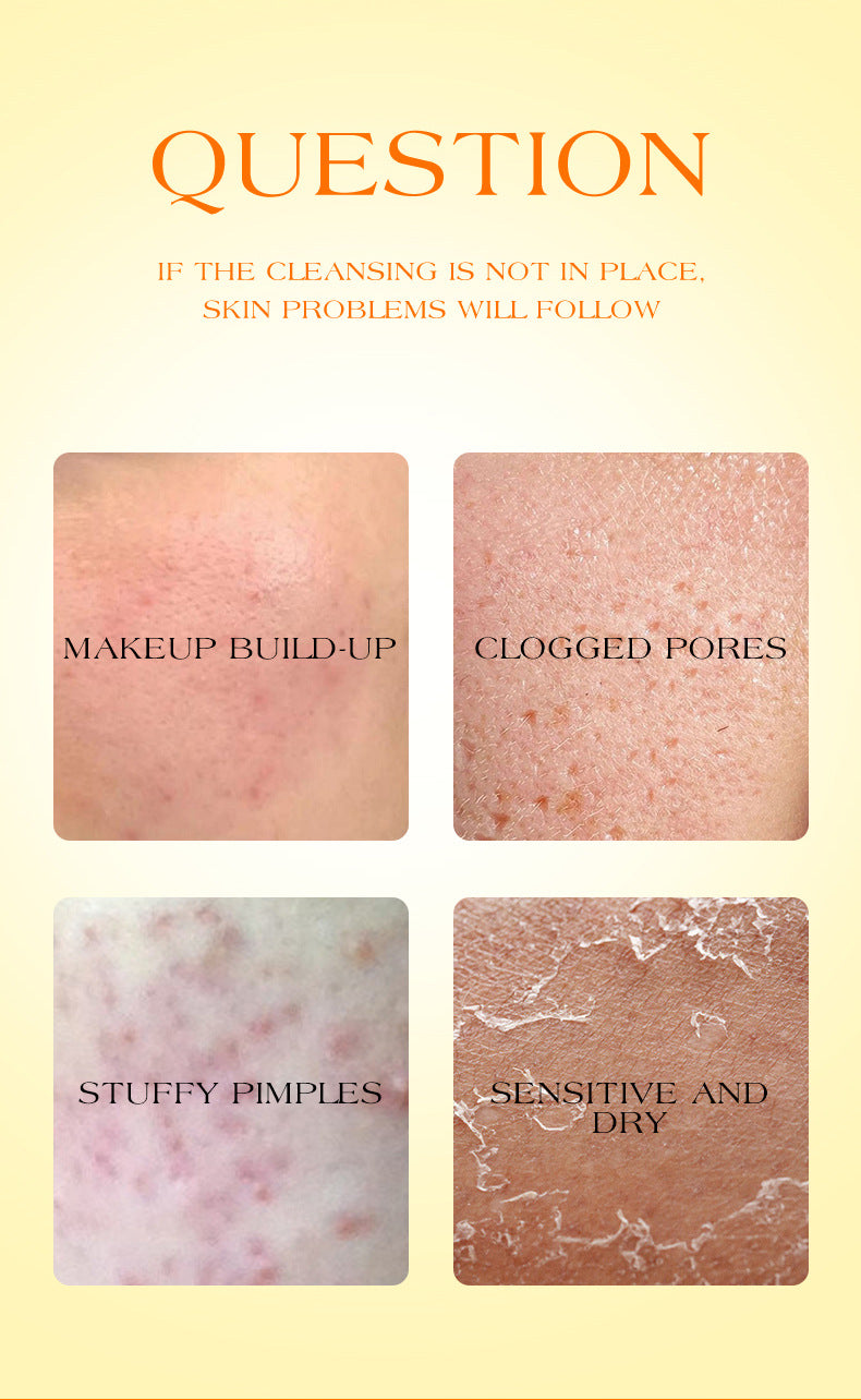 ICVC#Makeup Remover Cream Facial Cleansing Easy Makeup Removal Vitamin C Moisturizing cream30g Packaging European Beauty Makeup