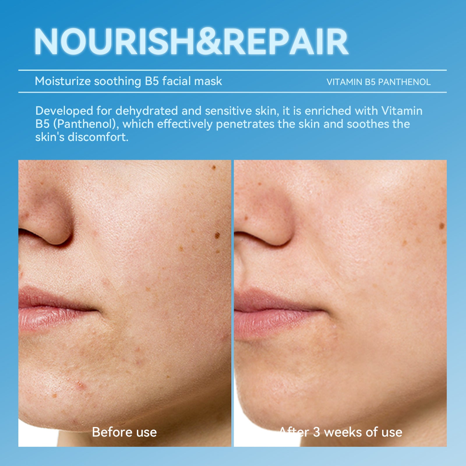 Hydrating and Soothing B5Facial Mask Hydrating Moisturizing Brightening Dullness Emergency Repair Soothing Sensitive Skin Mask Set