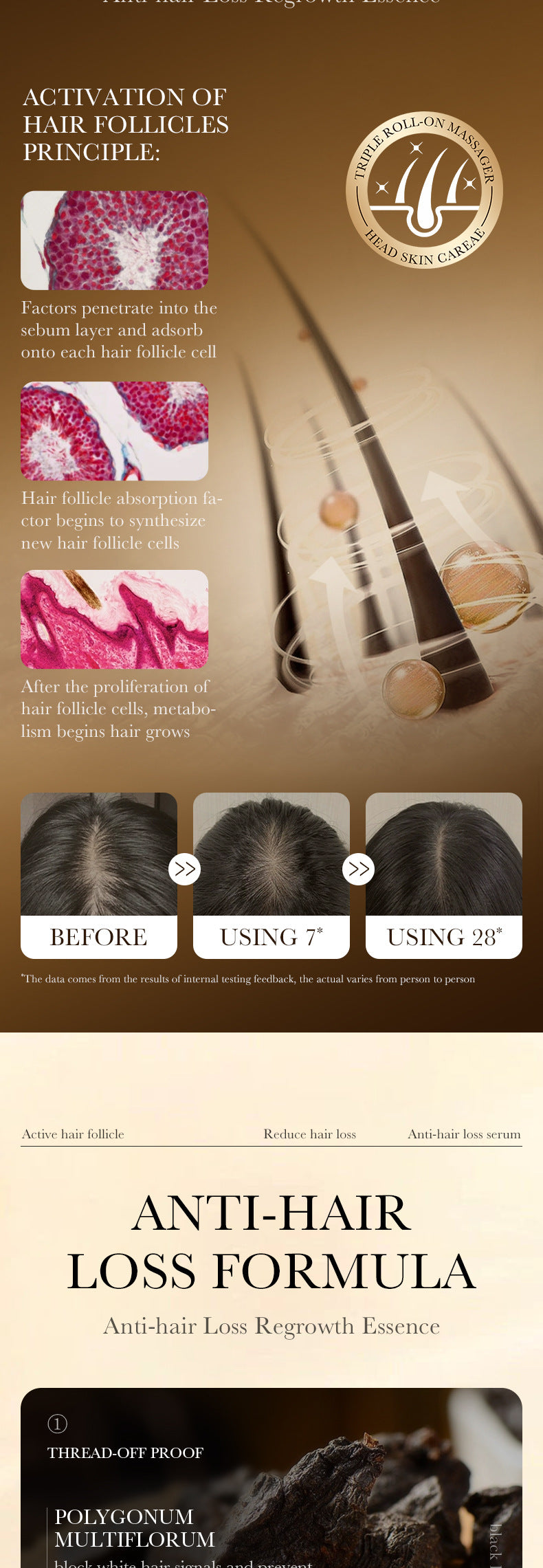 Anti-Hair Loss Serum ZOZU Strengthen Hair Roots Improve Hair Loss Hair Growth Essence  Wholesale