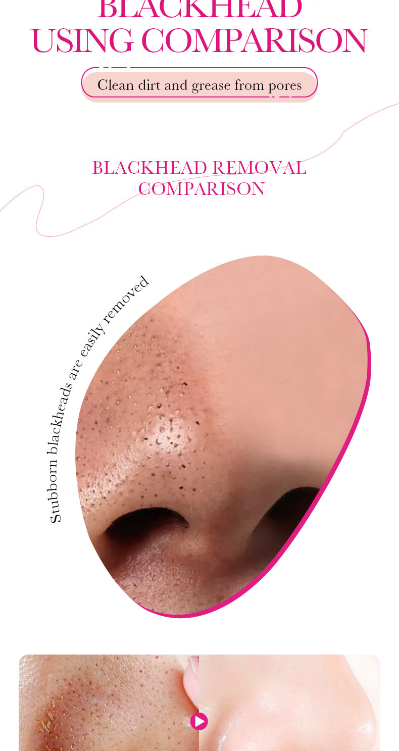 Bamboo Charcoal Women's Nose Strips SADOER Deep Cleansing Blackhead Removal Nose Strips  Wholesale
