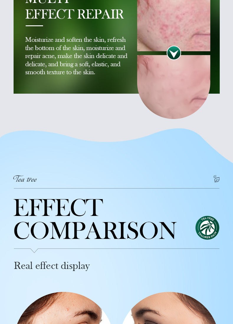 Tea Tree Skincare Set SADOER Cleansing, moisturizing, hydrating five-piece set for  foreign trade wholesale