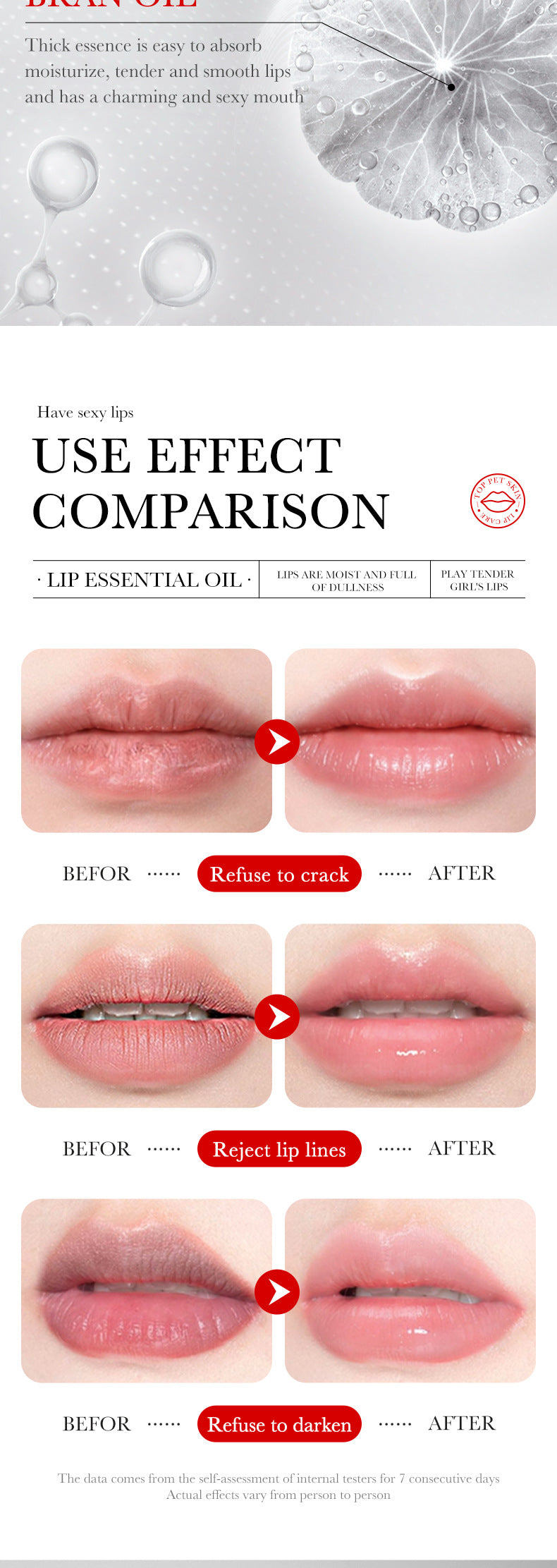 Lip Care Essence Oil10ml SADOER Tender, smooth, moisturizing essential oil  wholesale