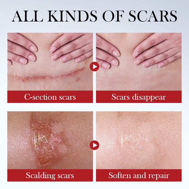 Scar Serum SADOER Hydrating, moisturizing, rejuvenating, nourishing face cream  foreign trade wholesale