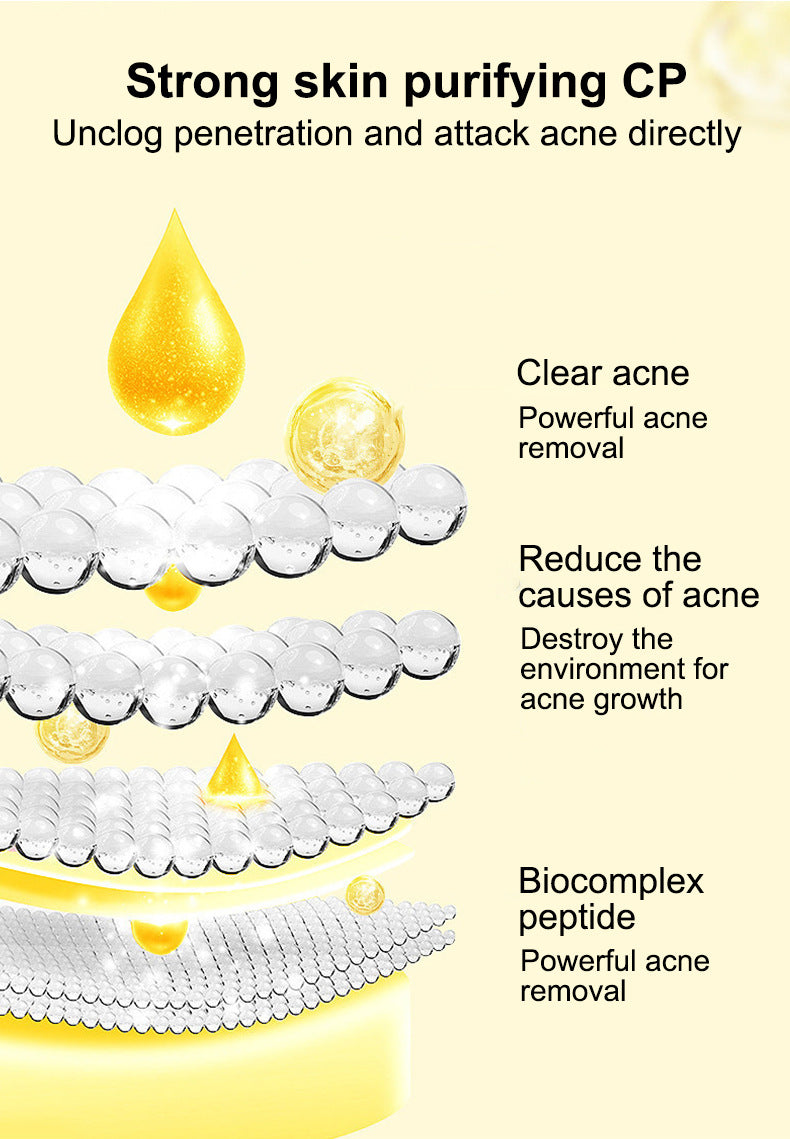In Stock Full Salicylic Acid Acne Treatment Skin Care Essence Acne Scar Removal Pore Minimizing Toner