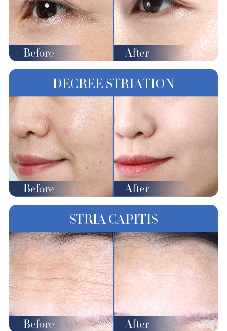 Bifid Yeast Mask30gBIOAOUA Hydrating Moisturizing Tablets for Cross-Border Wholesale