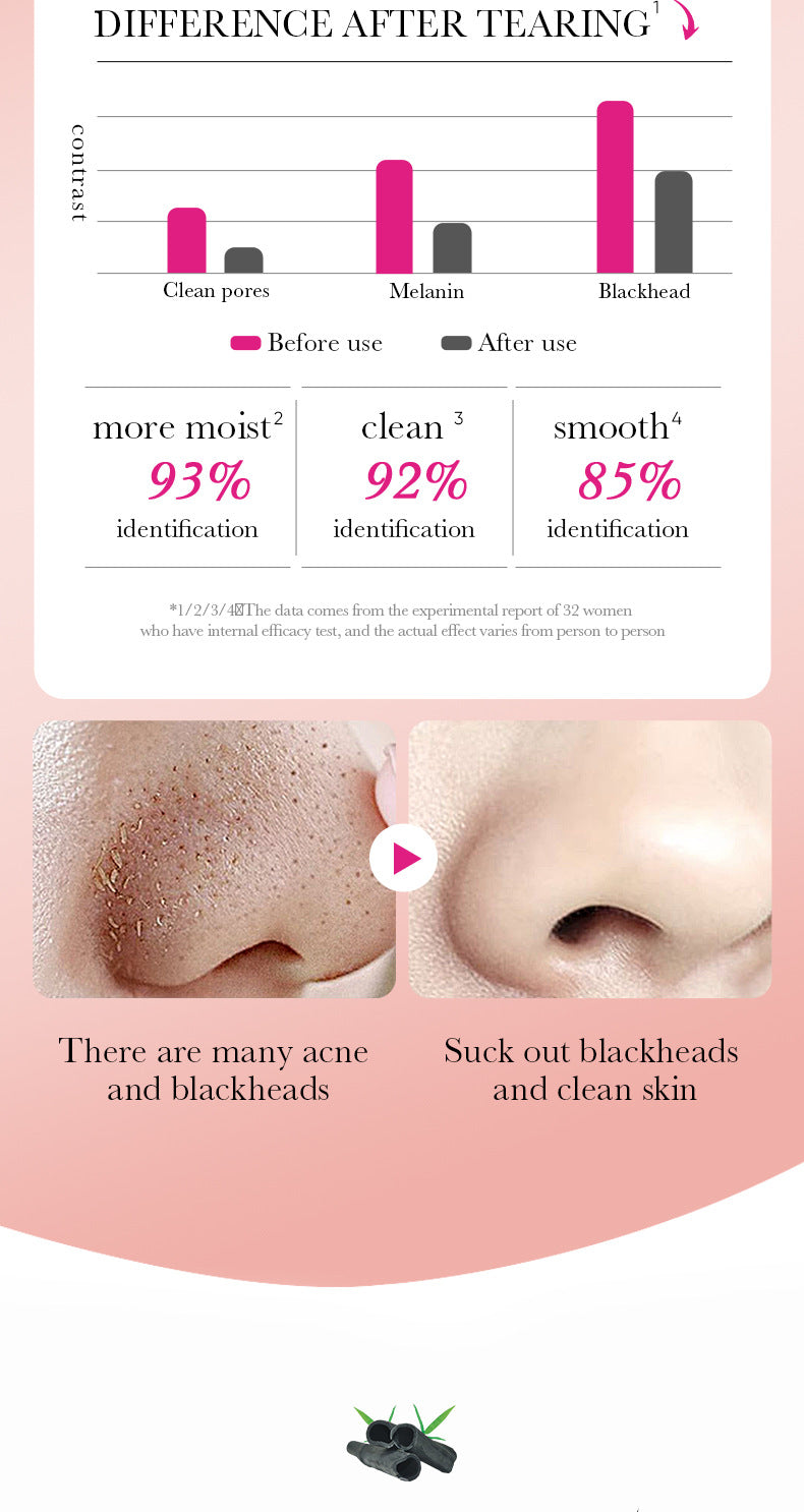 Bamboo Charcoal Women's Nose Strips SADOER Deep Cleansing Blackhead Removal Nose Strips  Wholesale