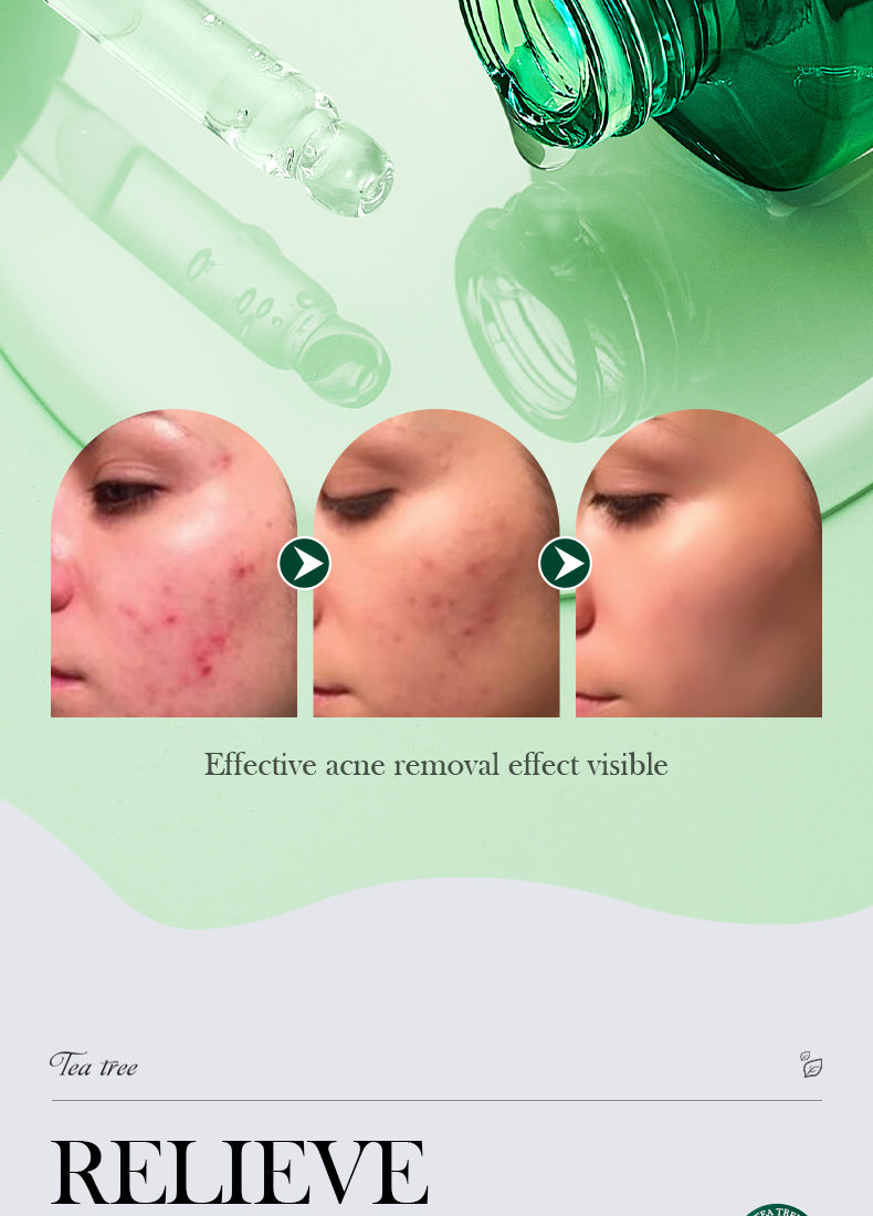 Tea Tree Essence30ml SADOER Moisturizing and refreshing cross-border foreign trade wholesale