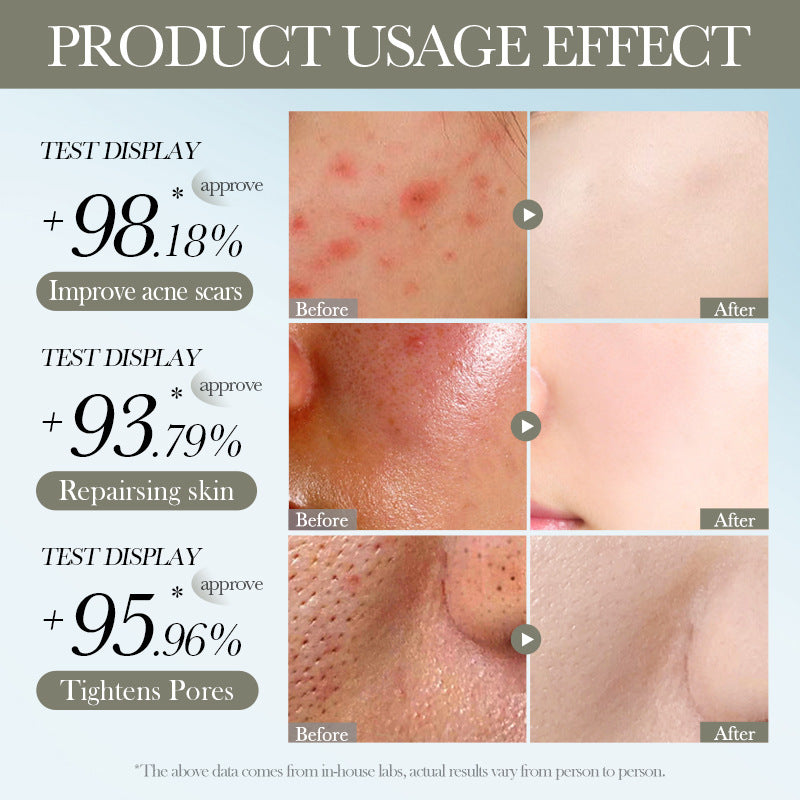 Salicylic Acid Anti-Acne Mask BIOAOUA Nourishing and Hydrating Moisturizing Face Mask Cross-Border Wholesale