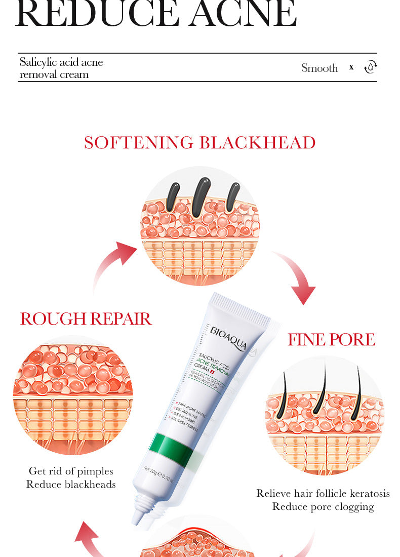 Cream BIOAOUA Salicylic Acid Moisturizing Hydrating Fading Acne Marks  Wholesale