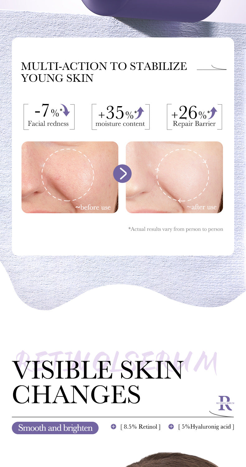 BIOAOUA Essence Series Hydrating and Nourishing Vitamins C Essence   Factory Direct Sales