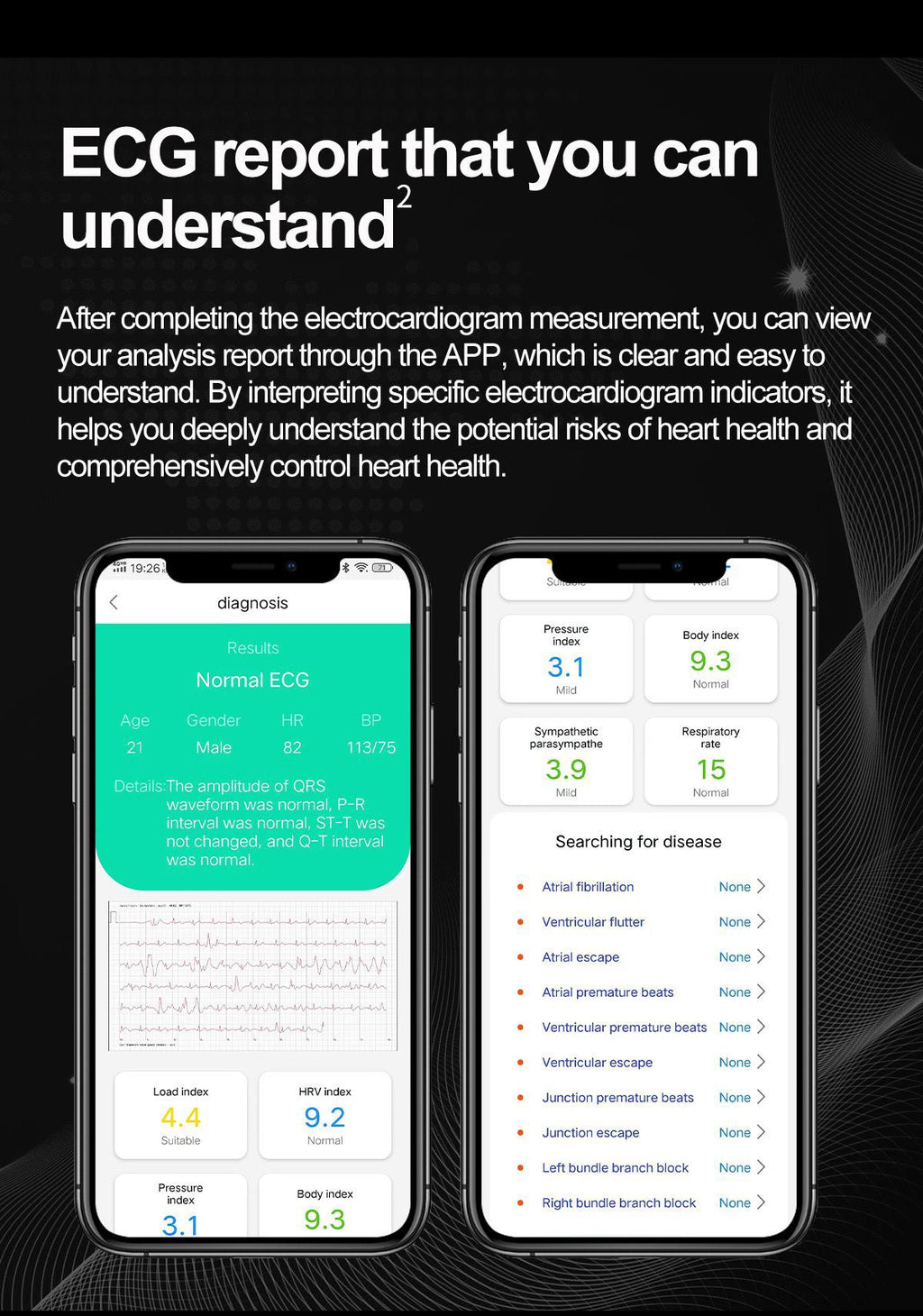 S15Smart watch air pump measures blood pressure and ECG NFC Bluetooth Call High-End Smart Watch APP Docking