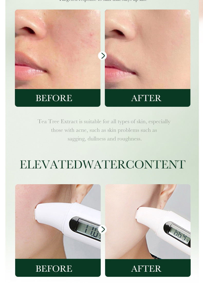 Tea Tree Skincare Set SADOER Cleansing, moisturizing, hydrating five-piece set for  foreign trade wholesale