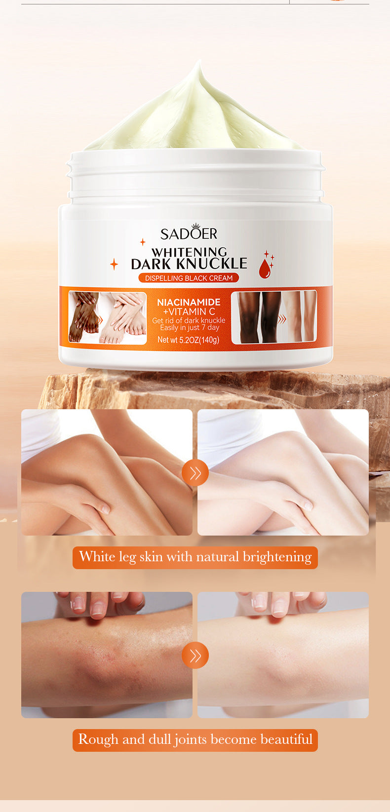 Joint Whitening and Dark Spot Removal Cream140g SADOER Vitamin C Moisturizing Body Lotion  Wholesale