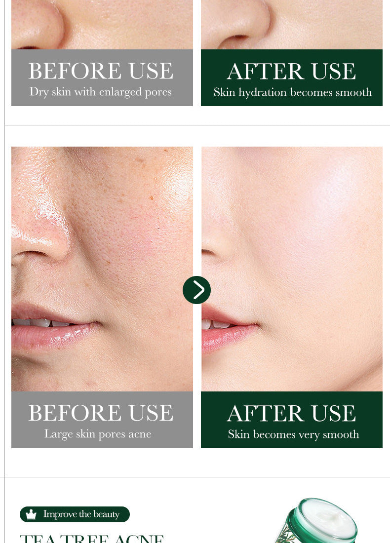 Tea Tree Skincare Set SADOER Cleansing, moisturizing, hydrating five-piece set for  foreign trade wholesale