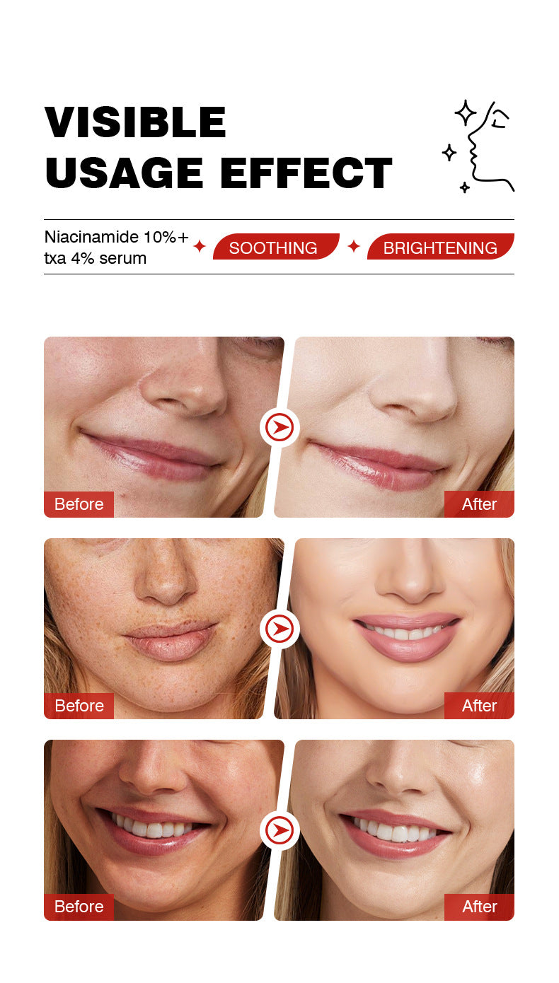 In Stock Niacinamide10+TXA4Essence Facial Set Gentle Moisturizing Skin Essence