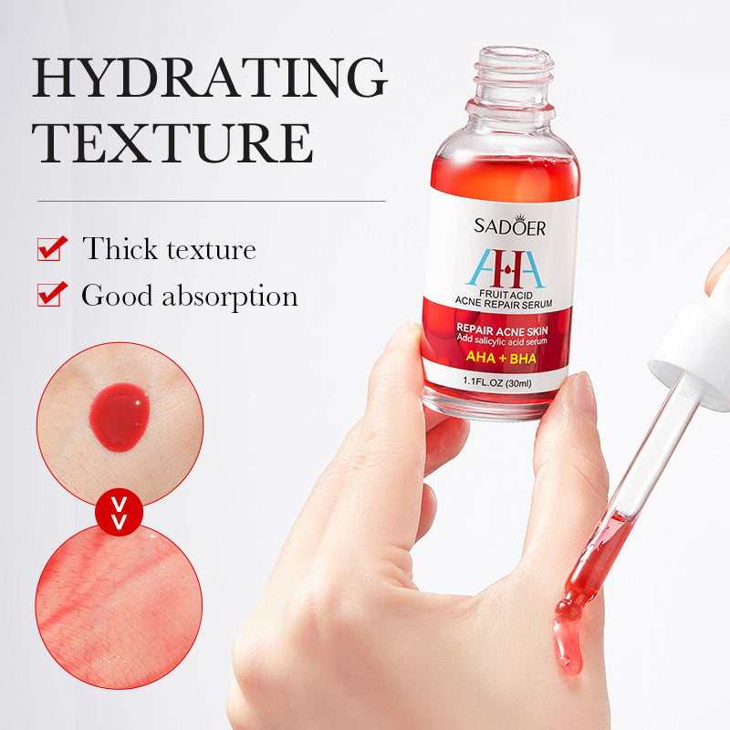 Anti-acne Serum SADOER Fruit Acid Fades Acne Marks, Hydrates and Moisturizes, Cross-Border Wholesale