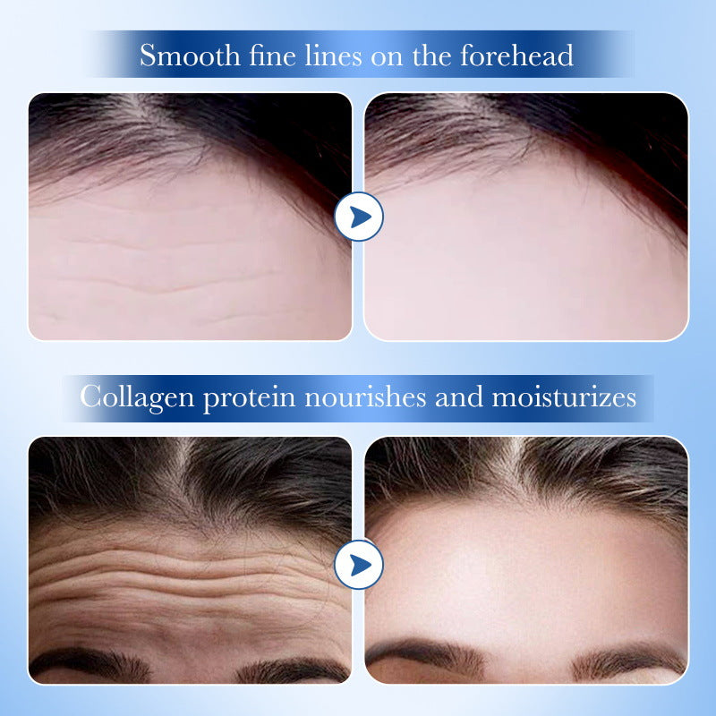 Hyaluronic Acid Forehead Patch SADOER Collagen Firming Improves Forehead Wrinkles  Wholesale