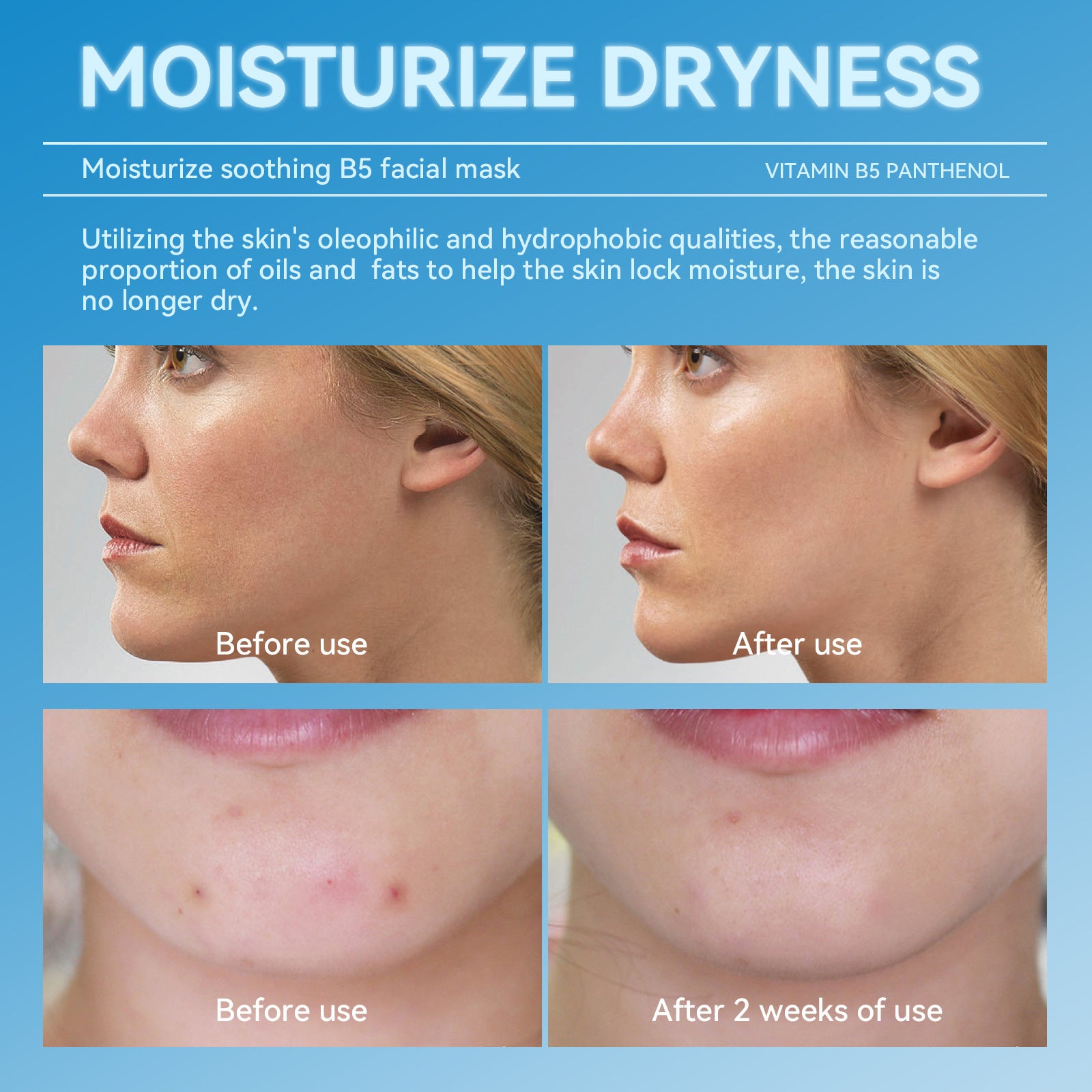 Hydrating and Soothing B5Facial Mask Hydrating Moisturizing Brightening Dullness Emergency Repair Soothing Sensitive Skin Mask Set