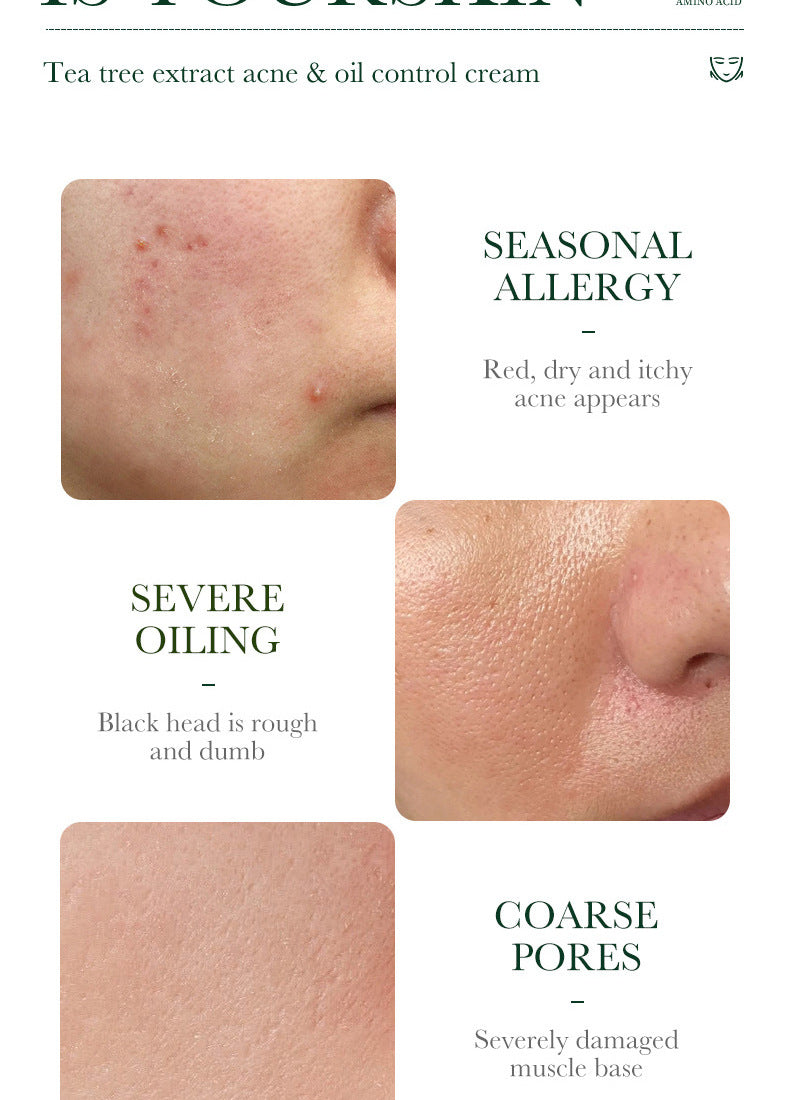 Tea Tree Skincare Set SADOER Cleansing, moisturizing, hydrating five-piece set for  foreign trade wholesale