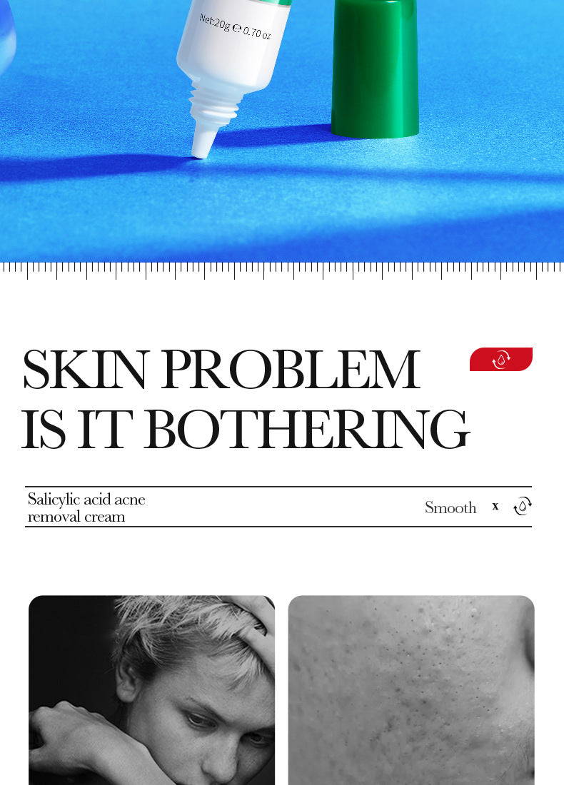 Cream BIOAOUA Salicylic Acid Moisturizing Hydrating Fading Acne Marks  Wholesale