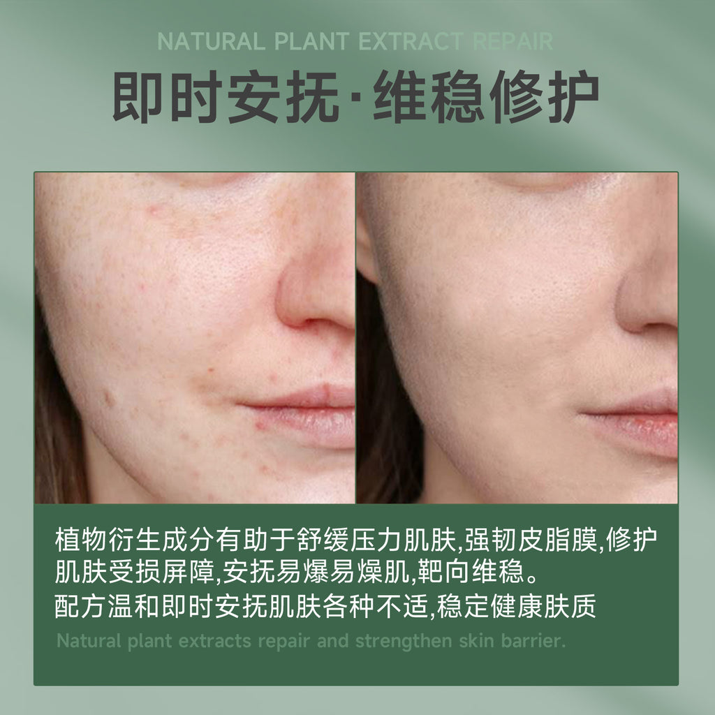 SHELOVES Centella Asiatica Essence Stick Soothing After-Sun Redness Sensitive Cooling Ice Hydrating No-Wash Essence Stick