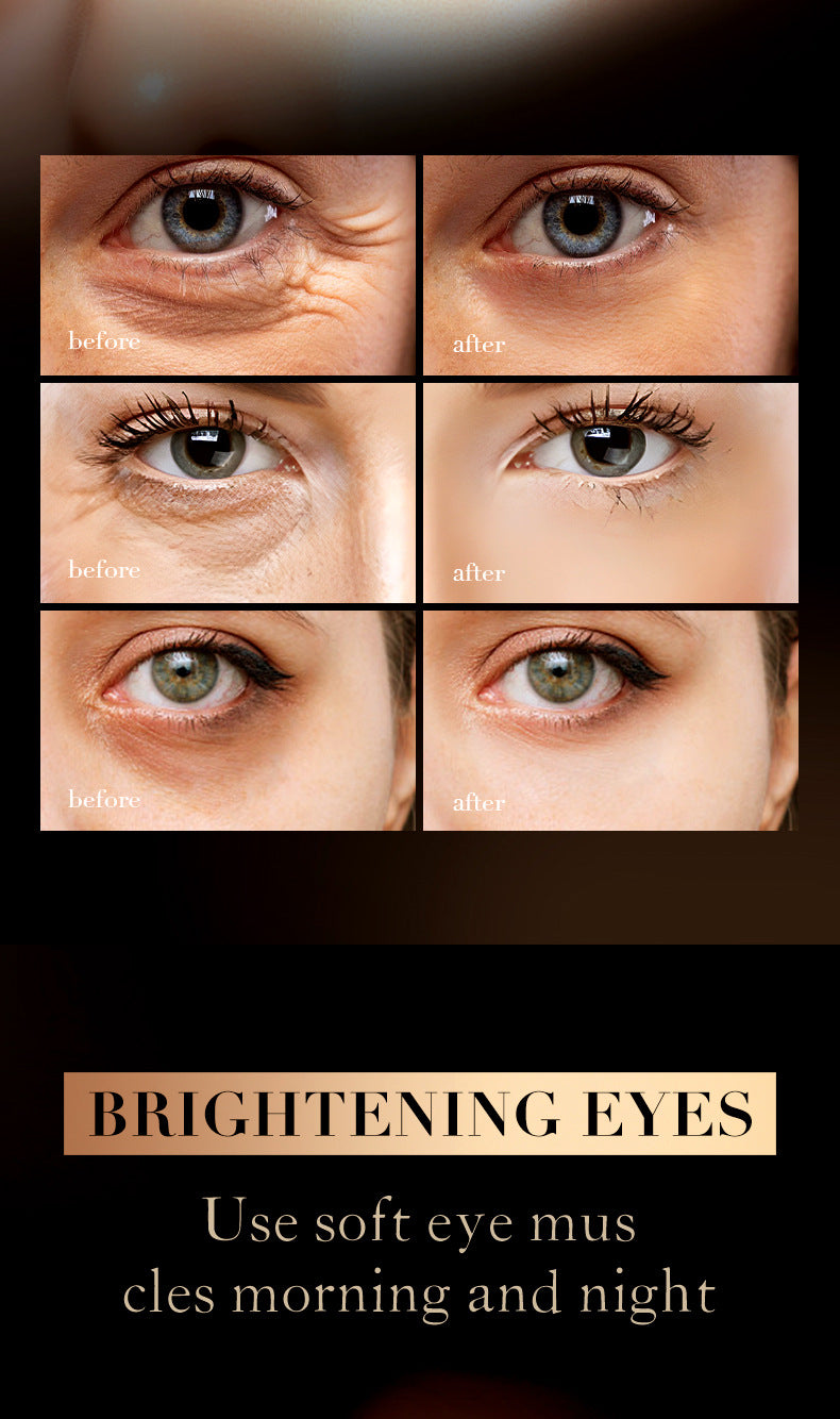 Retinol Caffeine Eye Cream SADOER Improve Dark Circles, Eye Wrinkles, and Eye Bags  Wholesale