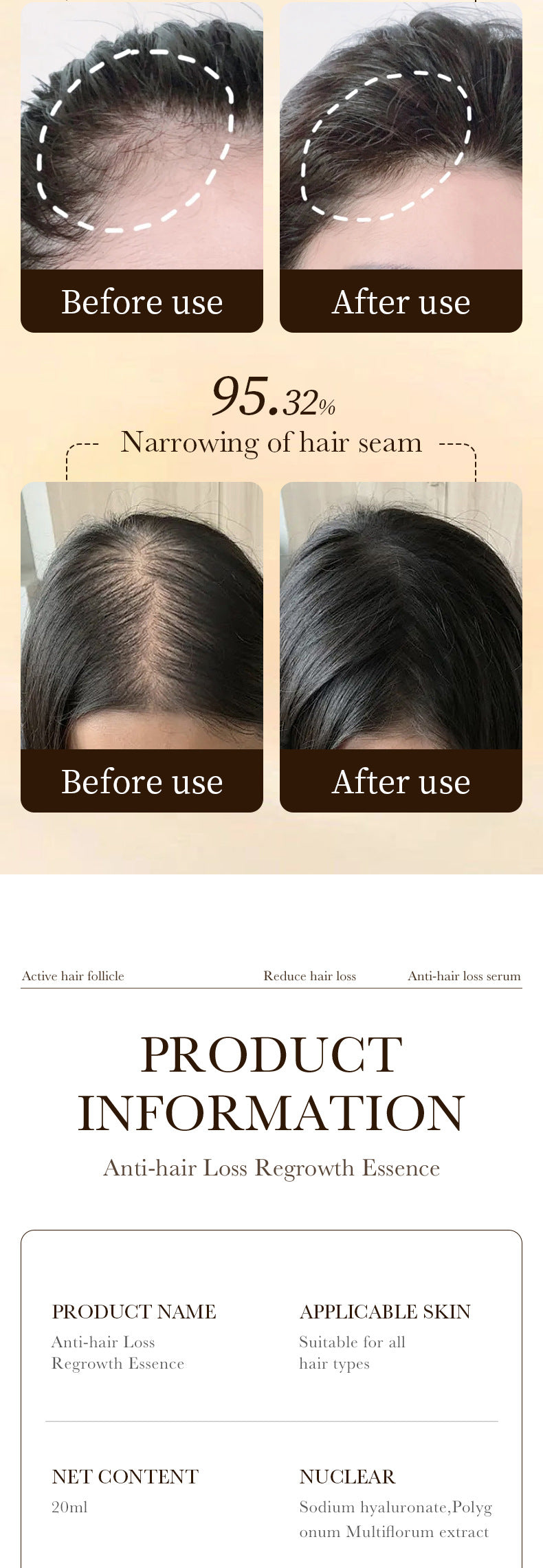 Anti-Hair Loss Serum ZOZU Strengthen Hair Roots Improve Hair Loss Hair Growth Essence  Wholesale