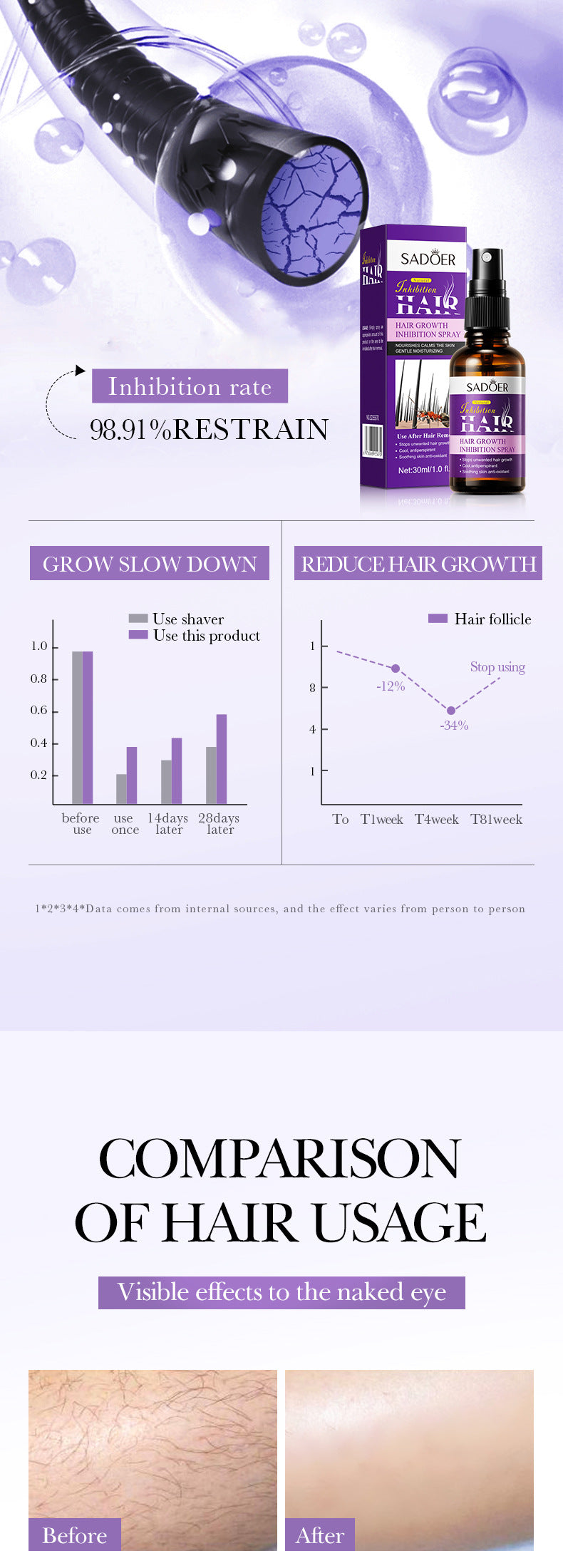 Hair Growth Inhibitor Spray SADOER Inhibiting Underarm and Leg Hair Spray  Wholesale