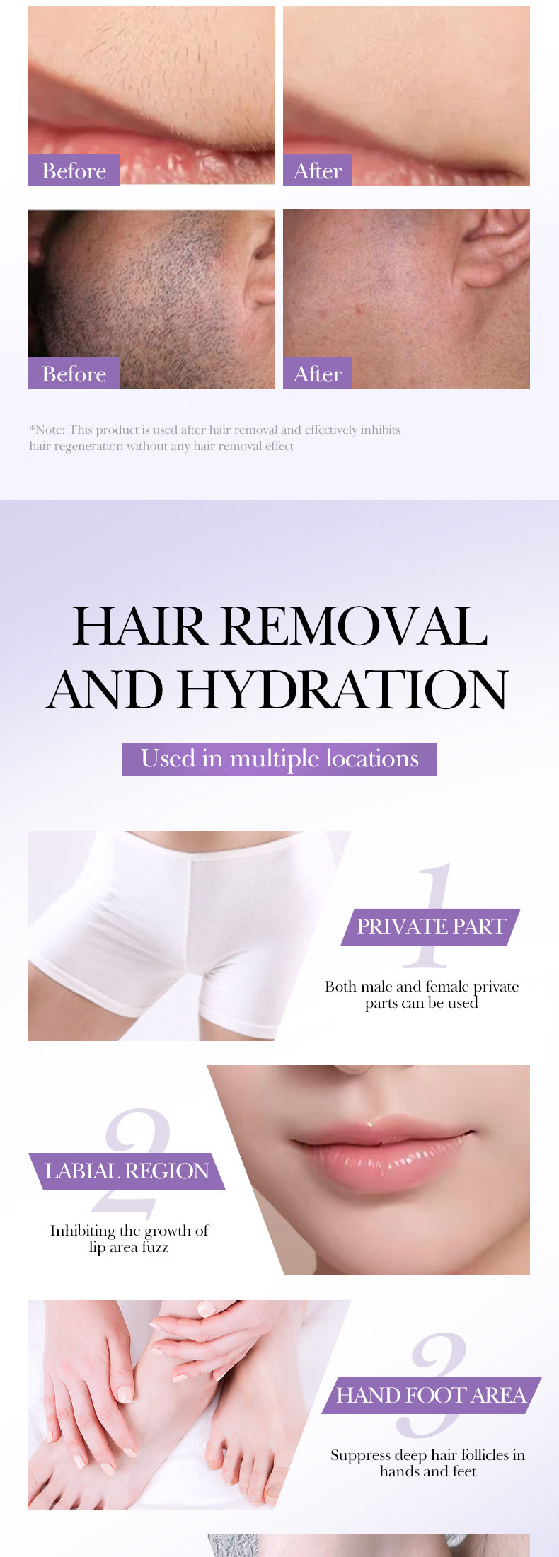 Hair Growth Inhibitor Spray SADOER Inhibiting Underarm and Leg Hair Spray  Wholesale