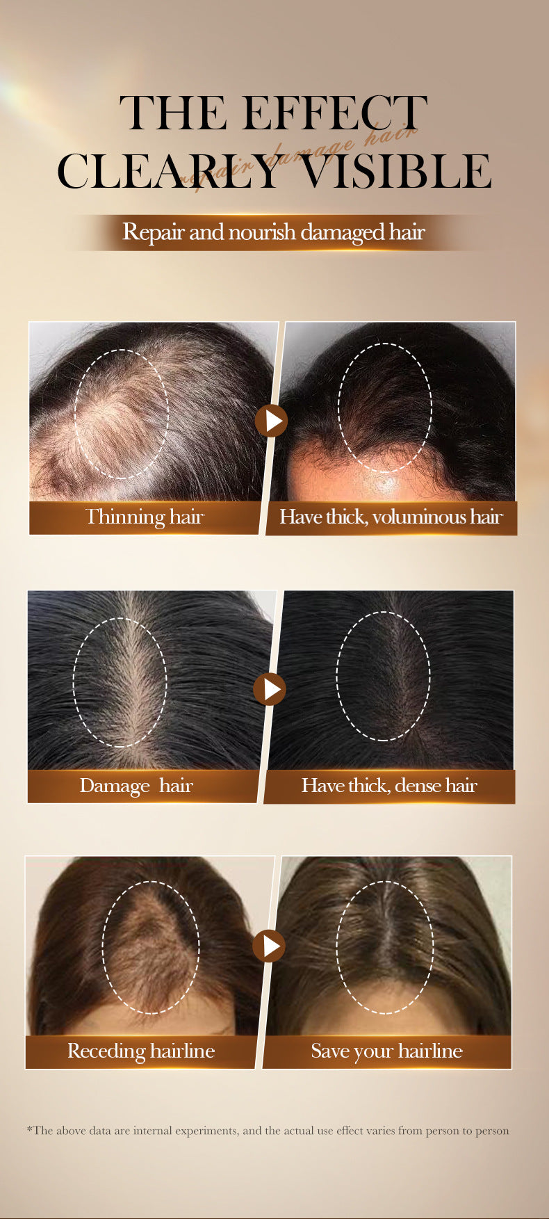 Batahana Hair Oil SADOER Scalp Soothing Smooth Conditioner Cross-Border Wholesale