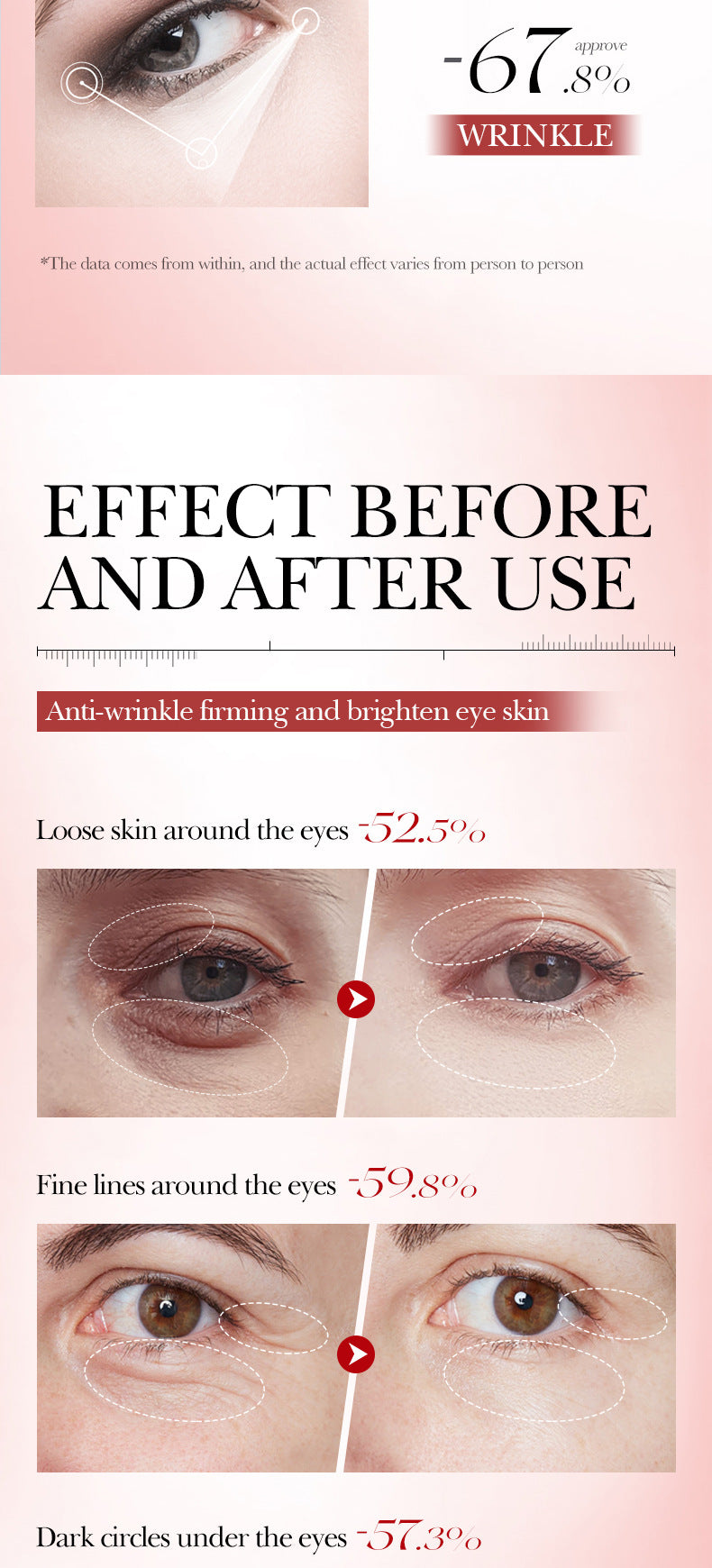 Snail Moisturizing Eye Cream BIOAOUA Hydrating and Moisturizing Eye Cream for Cross-Border Wholesale