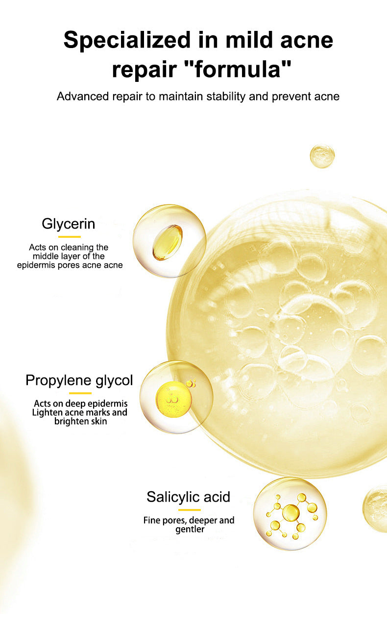 In Stock Full Salicylic Acid Acne Treatment Skin Care Essence Acne Scar Removal Pore Minimizing Toner