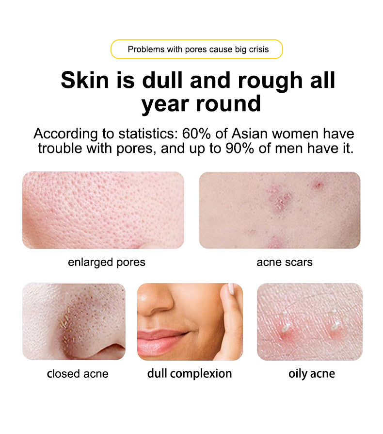In Stock Full Salicylic Acid Acne Treatment Skin Care Essence Acne Scar Removal Pore Minimizing Toner